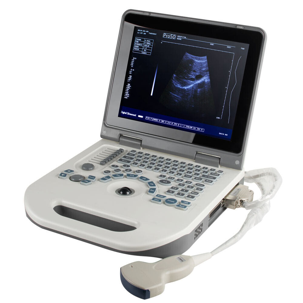 Digital Ultrasound Machine Scanner Diagnostic System 3.5mhz Convex Probe Carejoy