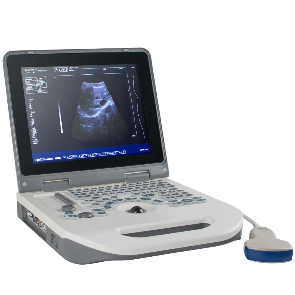 3.5mhz Convex Probe With Notebook Full Digital Ultrasound Scanner Diagnostic Fda
