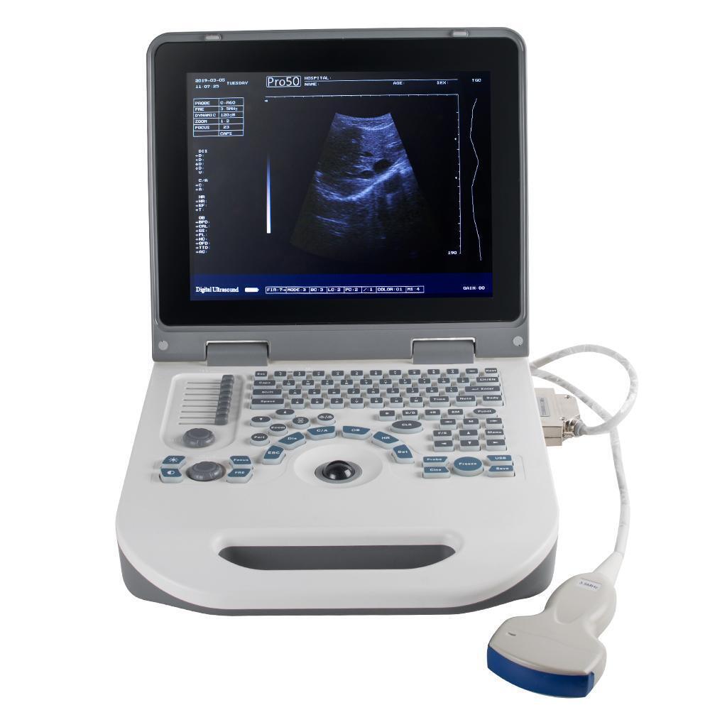 Laptop Diagnostic System 12.1inch Medical Ultrasound Scanner 3.5mhz Convex Probe