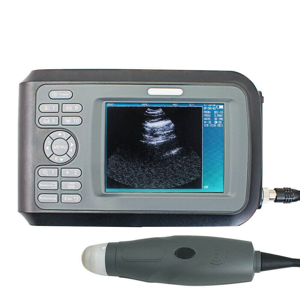 Carejoy Vet Ultrasound Scanner Digital Portable Veterinary Machine